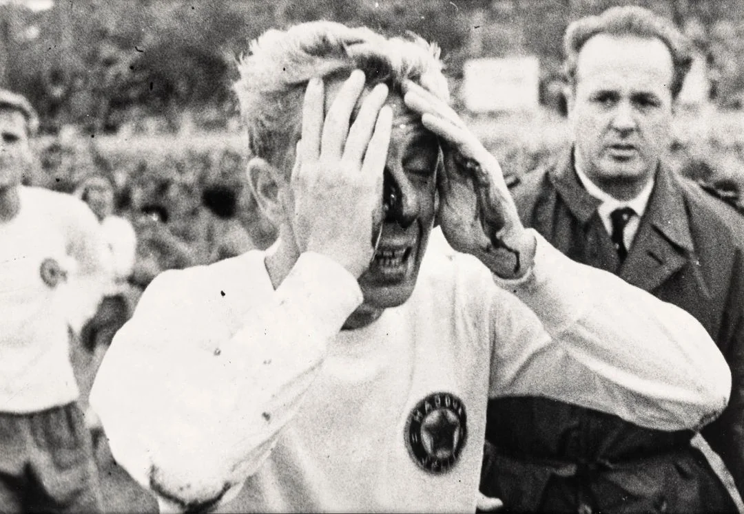 Sav obliven krvlju, u pratnji Vojka Andrijaševića, Vukas je napustio teren na Šubićevcu (Hajduk – Borac 3:0, 12.11.1961.) sredinom drugog poluvremena, kod vodstva Hajduka 2:0. Centralhalf Borca Atko Kasumović neoprezno je startao i kopačkom pogodio Vukasa u glavu, tako da su prve liječničke prognoze čak bile kobne, nije se moglo prosuditi hoće li Bajdo nastaviti karijeru.
